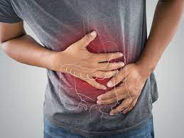 Inflammatory Bowel Disease